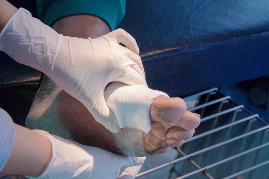 Wound Care Center Management Services Cost-Effective Solutions for Healthcare Providers